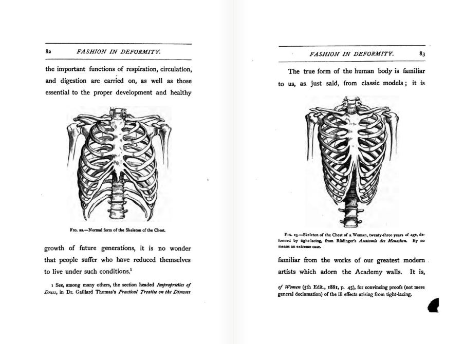 Victorian corset illustration from 1881 showing lacing and boned structure