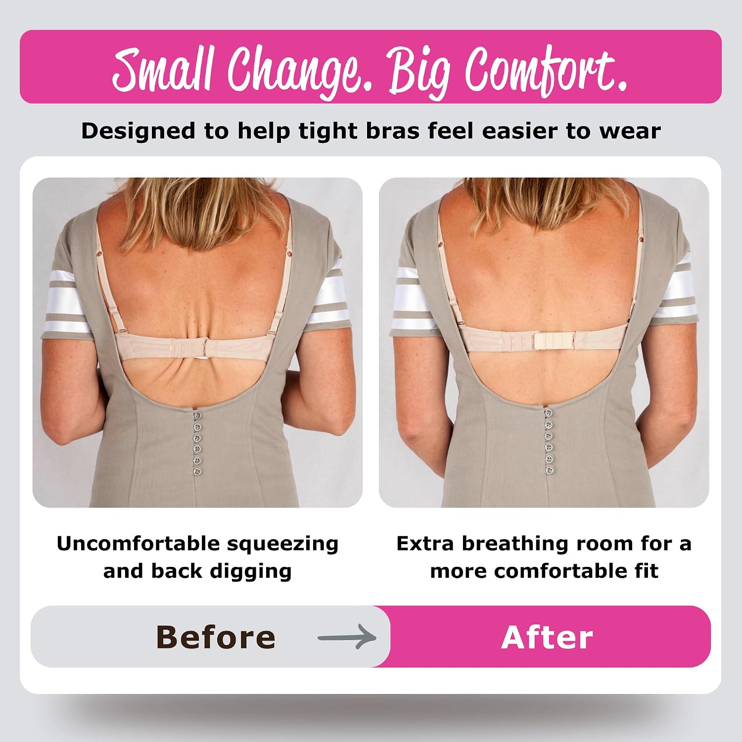Fashion First Aid Bra Extender Set — image 2